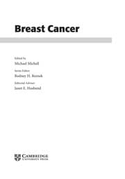 Cover of Breast cancer
